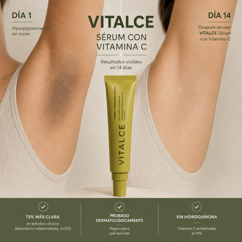 VITALCE™ – Sérum Antimanchas de Vitamina C + Glutatión